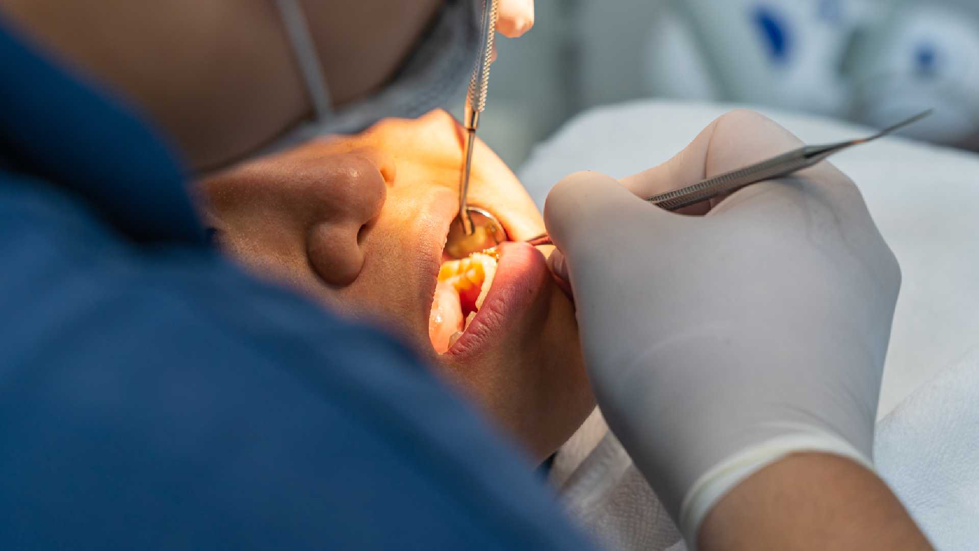 Urgent Dental Abscess Treatment: What You Need to Know