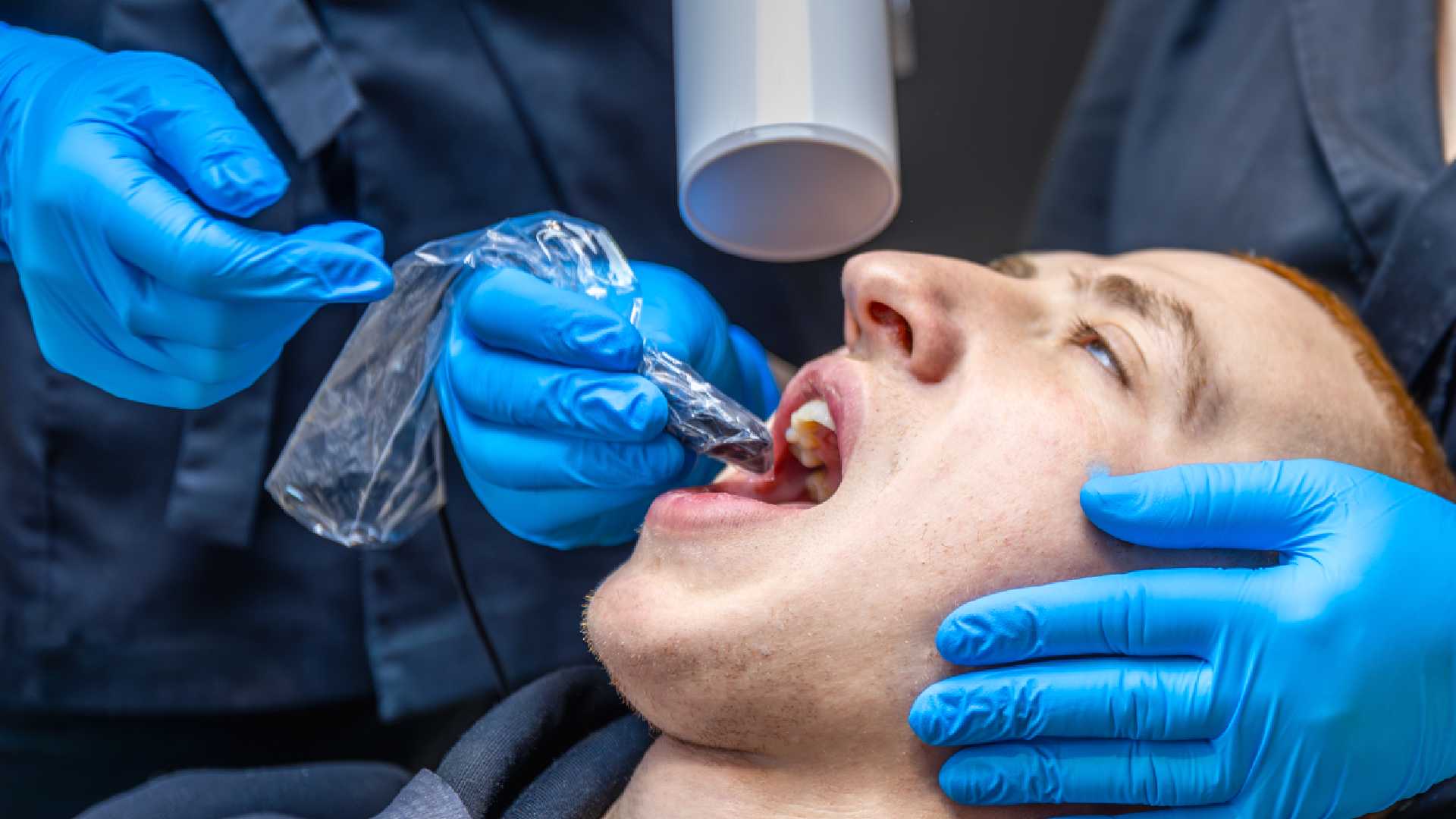Find Relief Fast at an Emergency Tooth Removal Clinic