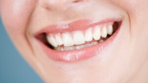 Teeth Healthy